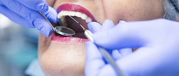 Best Emergency Tooth Extraction in Panorama Village, TX
