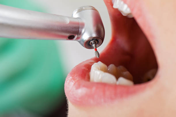 Best Pediatric Emergency Dentist in Panorama Village, TX